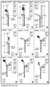 Delta 55021-RB Traditional Wallmount Handshower 