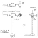 Delta 86T505 Metering Urinal Valve W/Stop